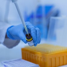 Studiu mondial: Un test de sânge poate detecta 50 de tipuri de cancer