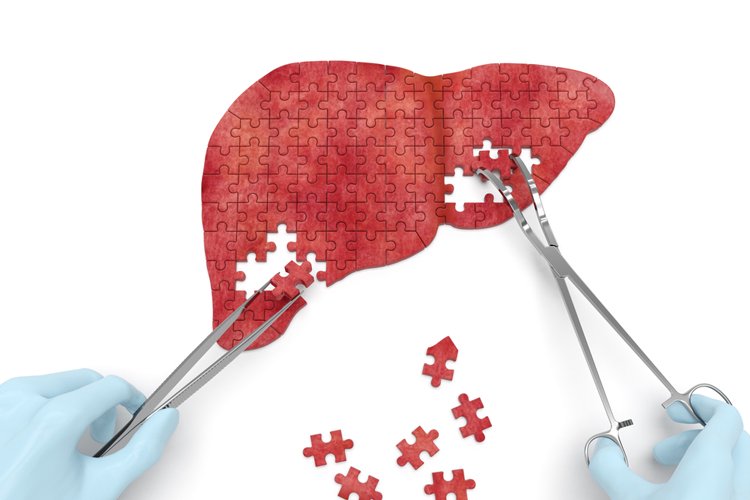 Macheta transplantului moldovenesc și cifrele în care a lovit pandemia